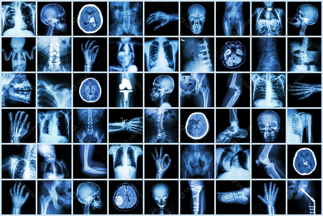 Conjunto coleção de doenças cerebrais