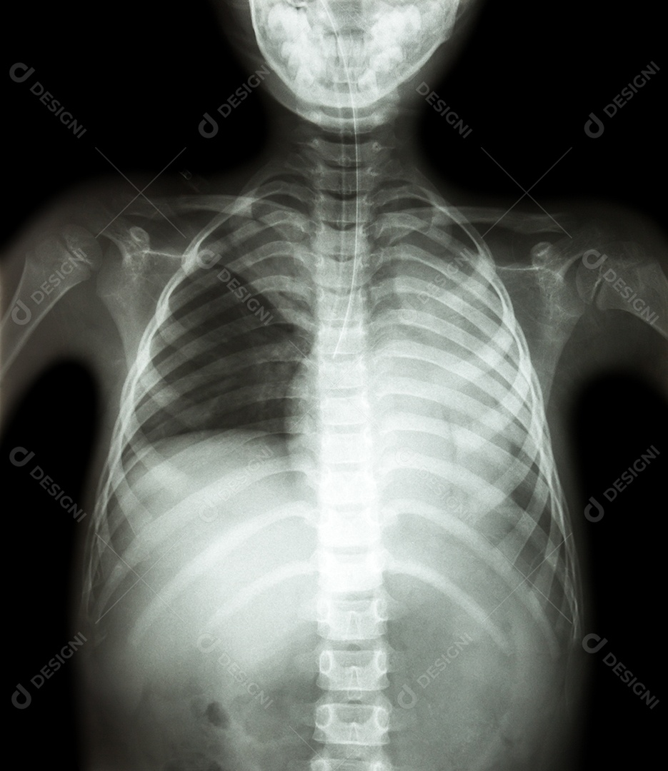 Raio x deo corpo de um adulto