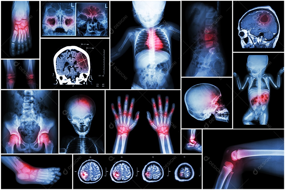 Raio x várias partes do corpo da criança e várias doença