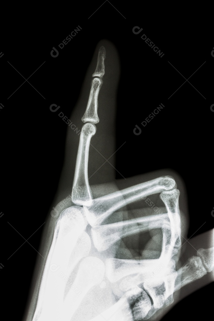 Filme raio x dedo indicador e mão apontar um dedo