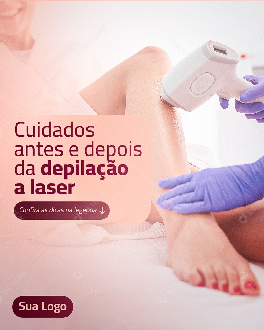 Post Estética Cuidados Antes e Depois da Depilação A LaserSocial Media PSD Editável