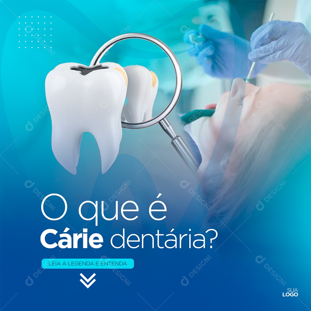 Post Odontologia O Que É Cárie Dentária Social Media PSD Editável