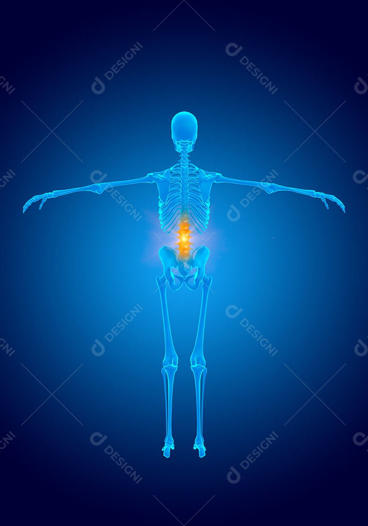 Esqueleto humano de holograma azul, desvio da coluna lombar de raios-x e desgaste da cartilagem causando dor. ilustração 3D