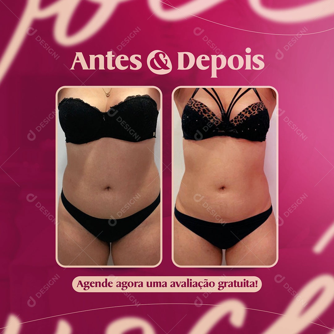 Antes & Depois Agende Agora um Avaliação Gratuita Clínica de Estética Social Media PSD Editável