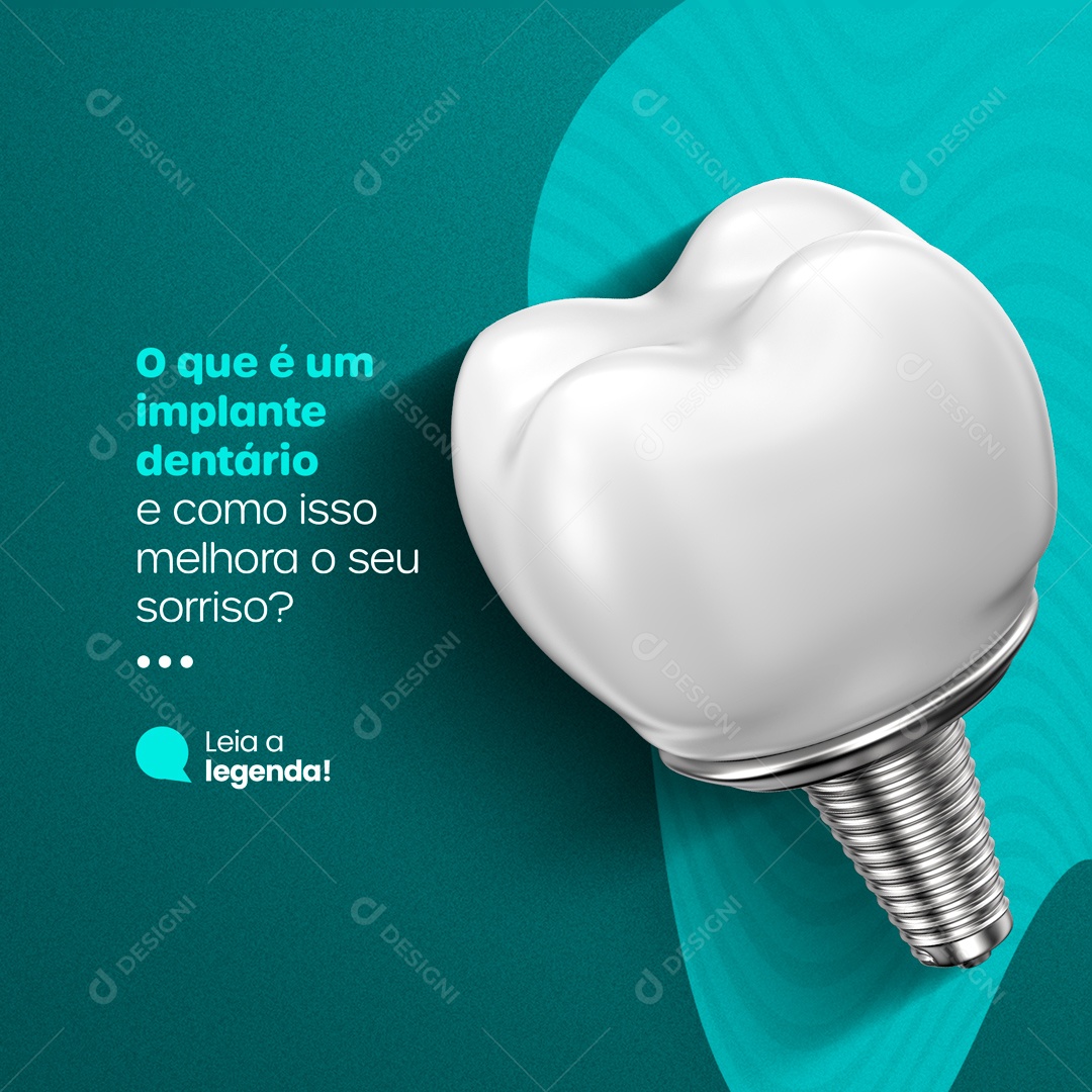 O Que é Um Implante Dentário? Consultório e Clínica Odontológica Dentista Social Media PSD Editável