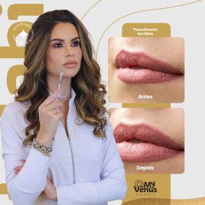 DIREITOS AUTORAIS Campanha Clínica de Estética Preenchimento dos Lábios Social Media PSD Editável