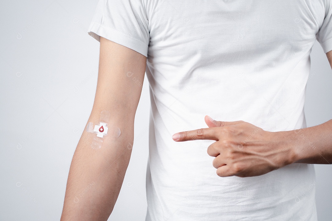 Homem mostrando gesso após doação de sangue, transfusão de sangue, dia mundial do doador de sangu