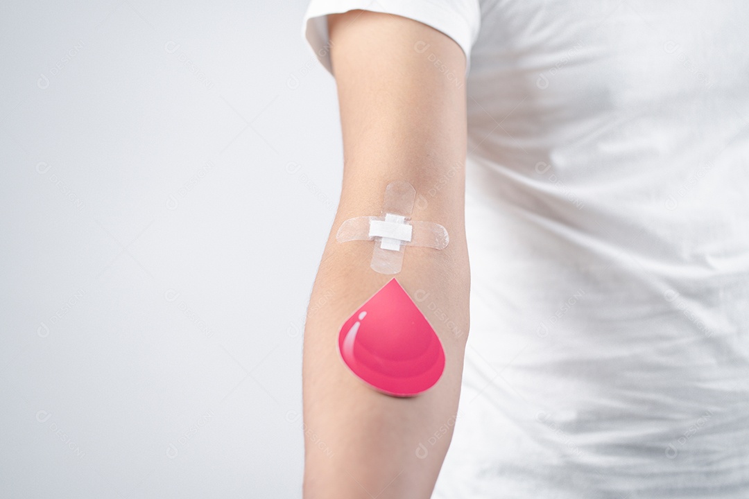 Homem mostrando gesso após doação de sangue, transfusão de sangue, dia mundial do doador de sangu