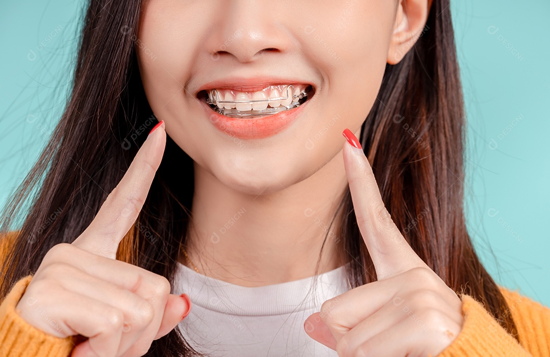 Sorriso bonito dental da jovem mulher asiática com aparelho retentor