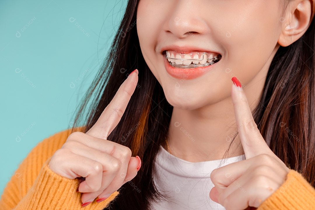 Sorriso bonito dental da jovem mulher asiática com aparelho retentor