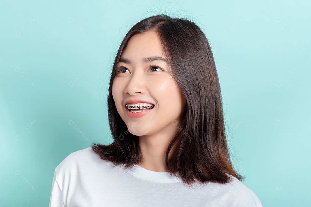 Aparelho dentário de jovem asiática com dentes brancos