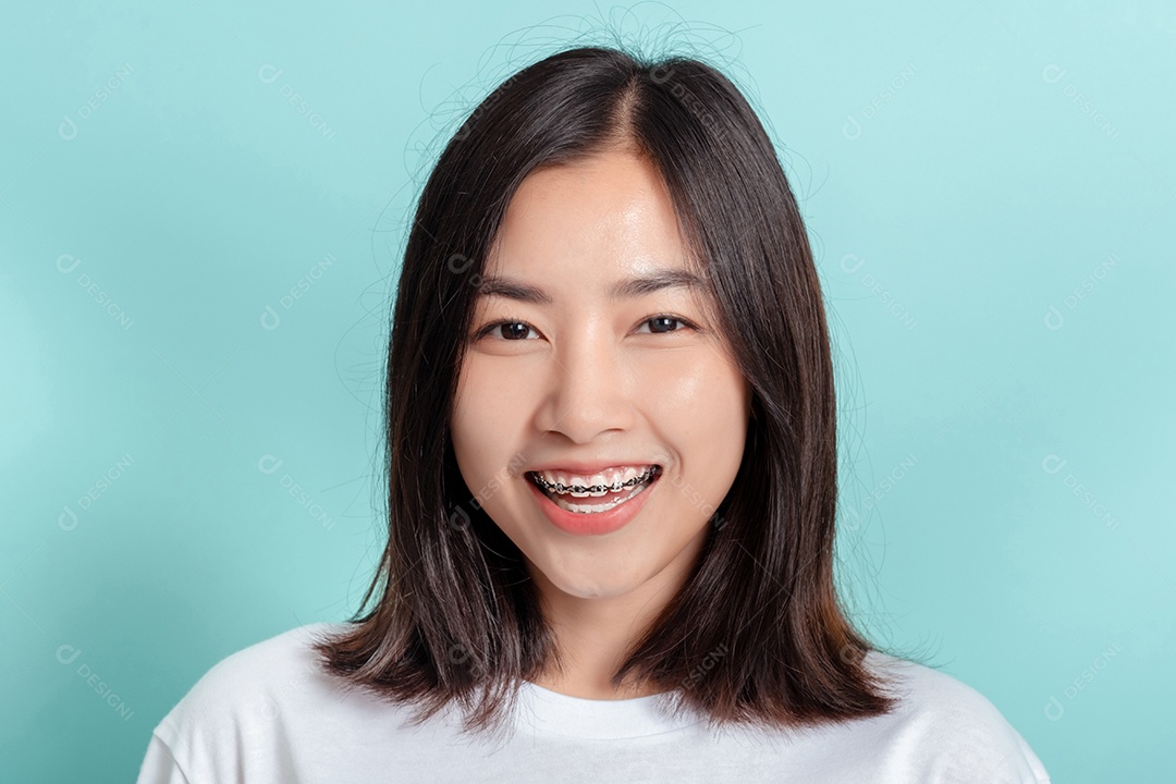 Aparelho dentário de jovem asiática com dentes brancos