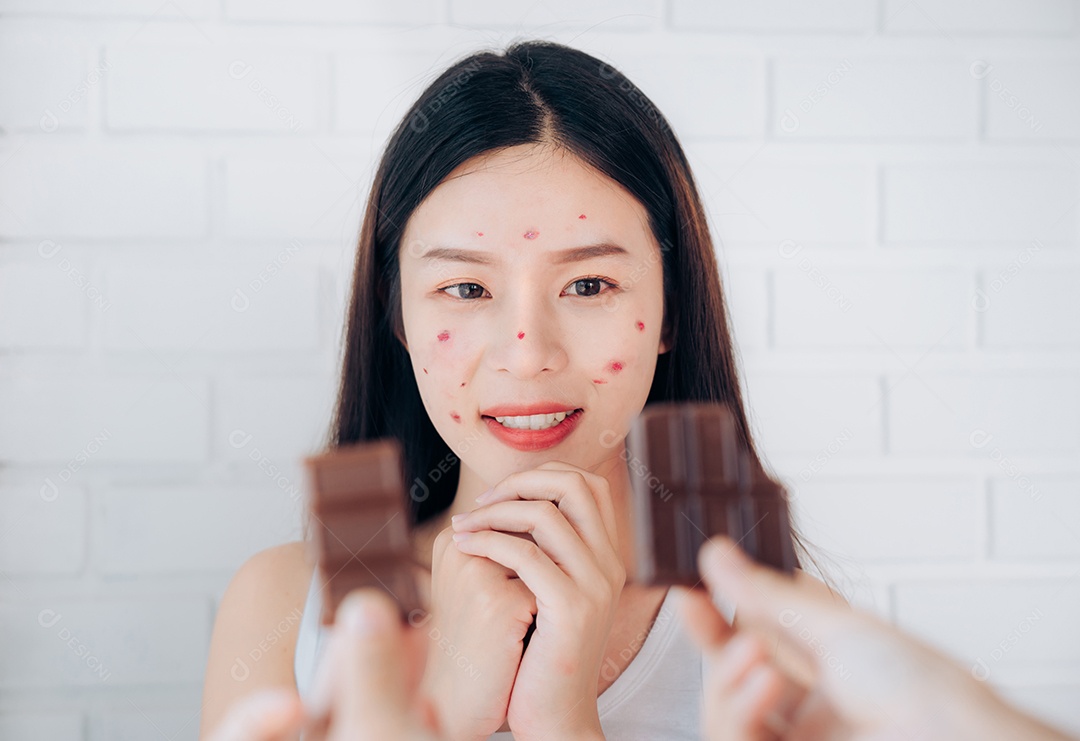 Face do problema da acne da jovem mulher asiática com barra de chocolate mas comendo feliz.