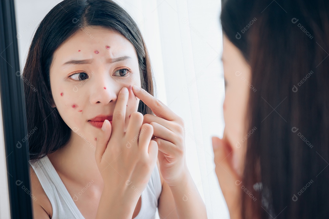 A jovem asiática com problema de acne no rosto