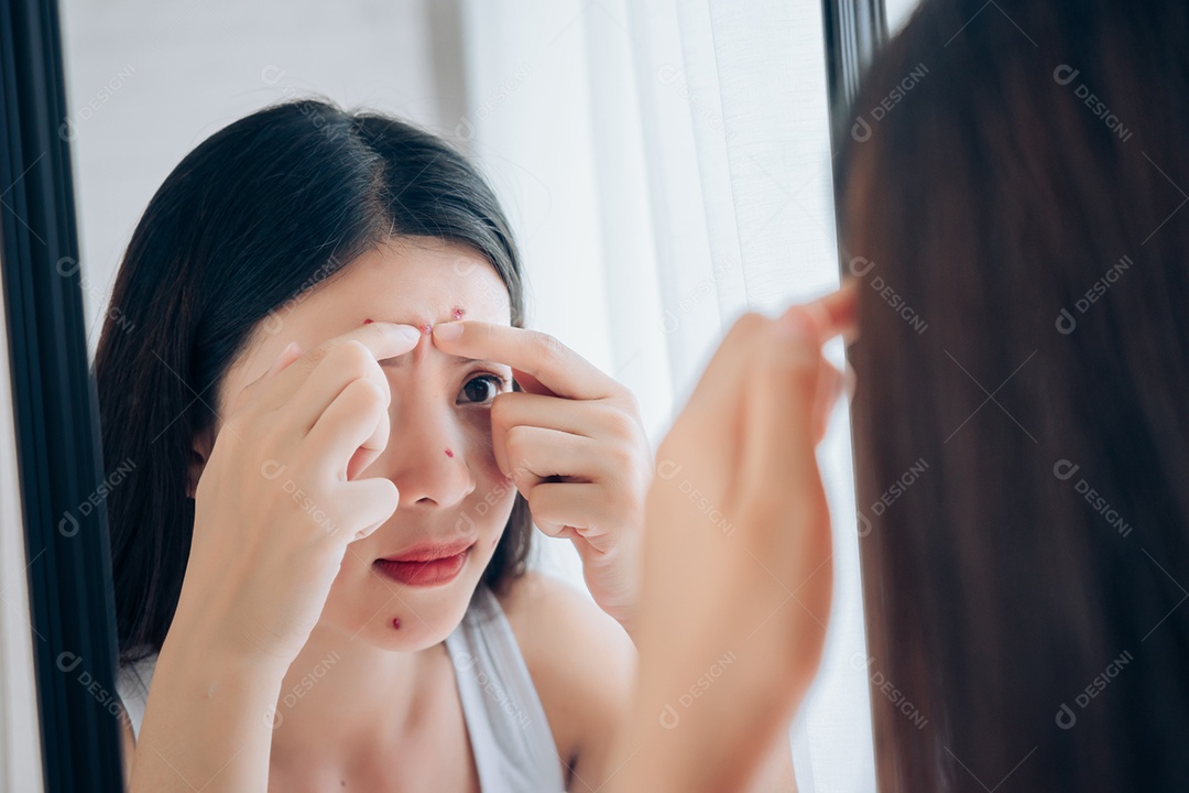 A jovem asiática espreme o rosto com problema de acne