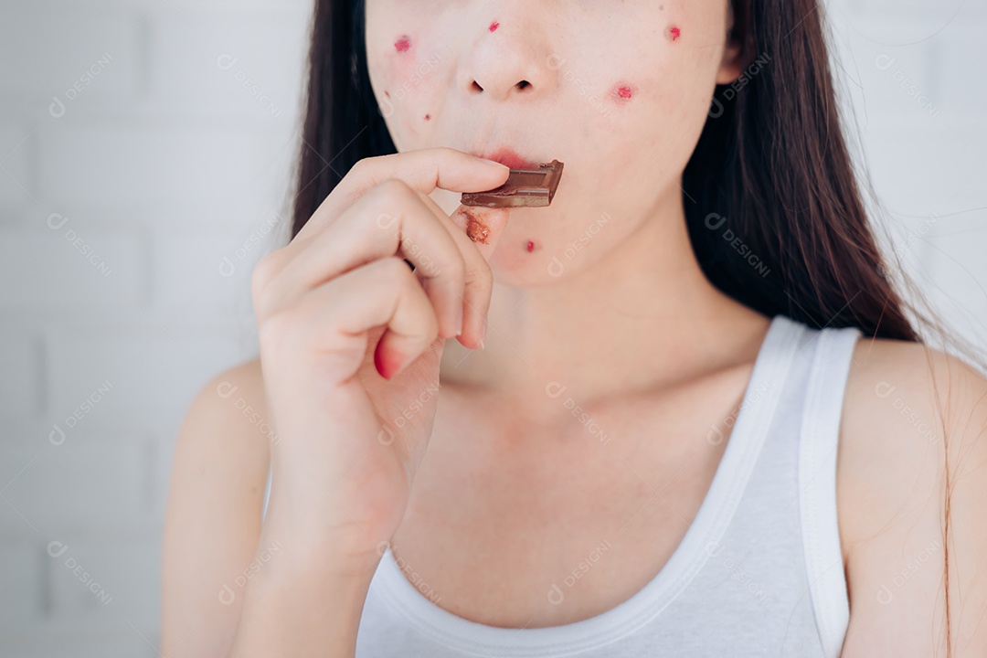 A jovem asiática com problema de acne no rosto