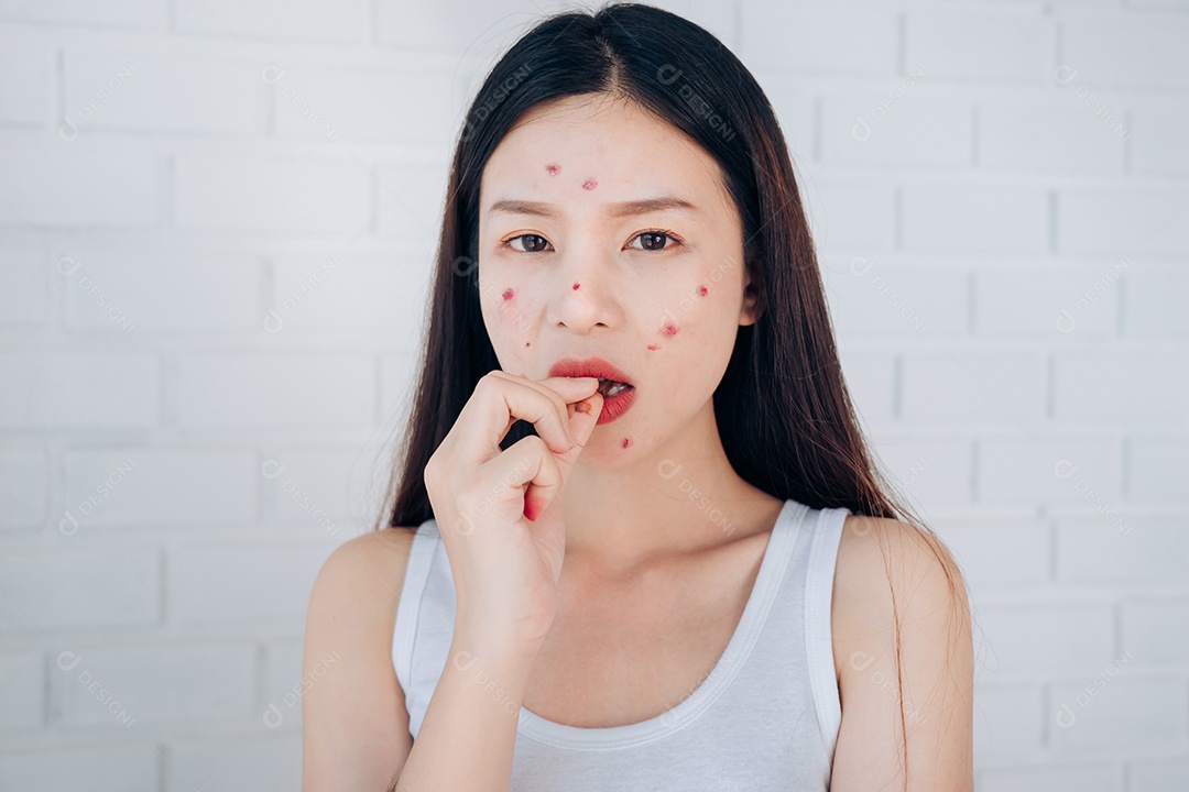 A jovem asiática com problema de acne no rosto