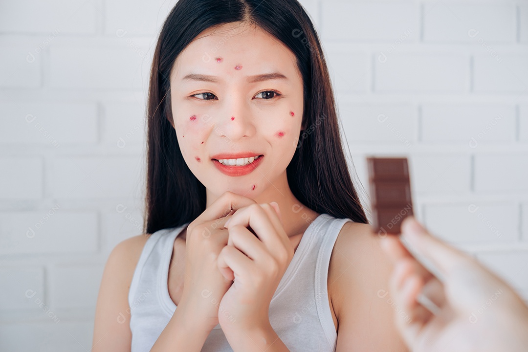 Face do problema da acne da jovem mulher asiática com barra de chocolate mas comendo feliz.