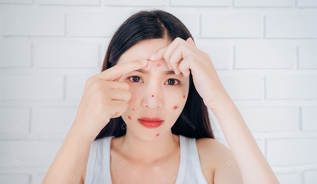 A jovem mulher asiática espreme o rosto com problema de acne