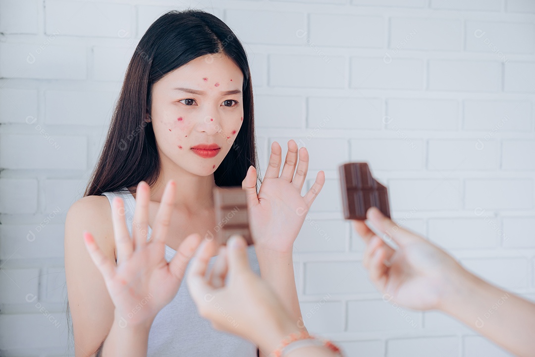 O rosto do problema de acne da jovem mulher asiática com barra de chocolate recusa uma alimentação