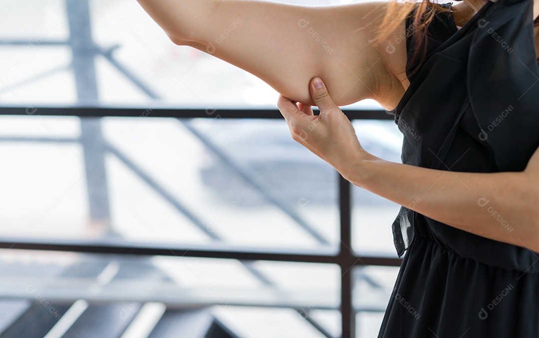 Mulher com excesso de peso segurando o excesso de gordura sob o braço direito.