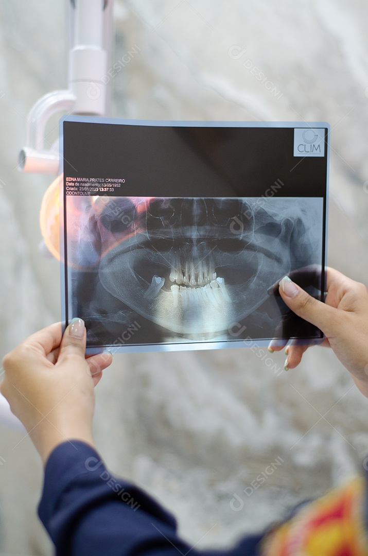 Dentista segurando raio x de uma boca um paciente