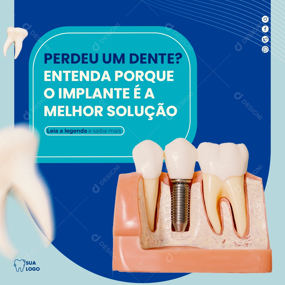 Social Media Feed Odontologia o Implante E A Melhor Solução PSD Editavel
