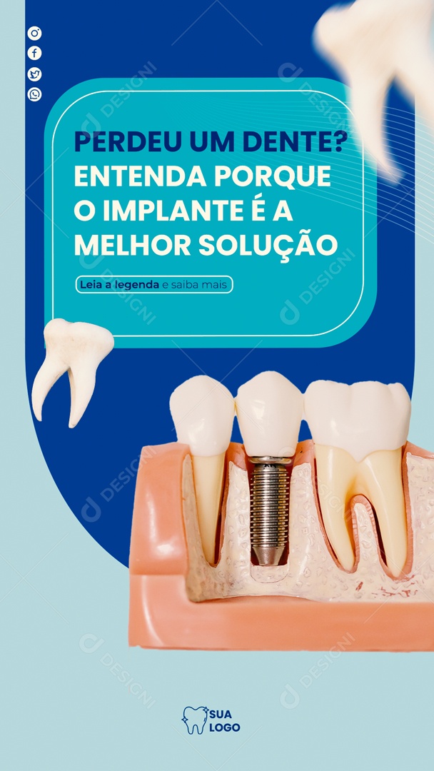 Story Social Media Odontologia o Implante E A Melhor Solução PSD Editável