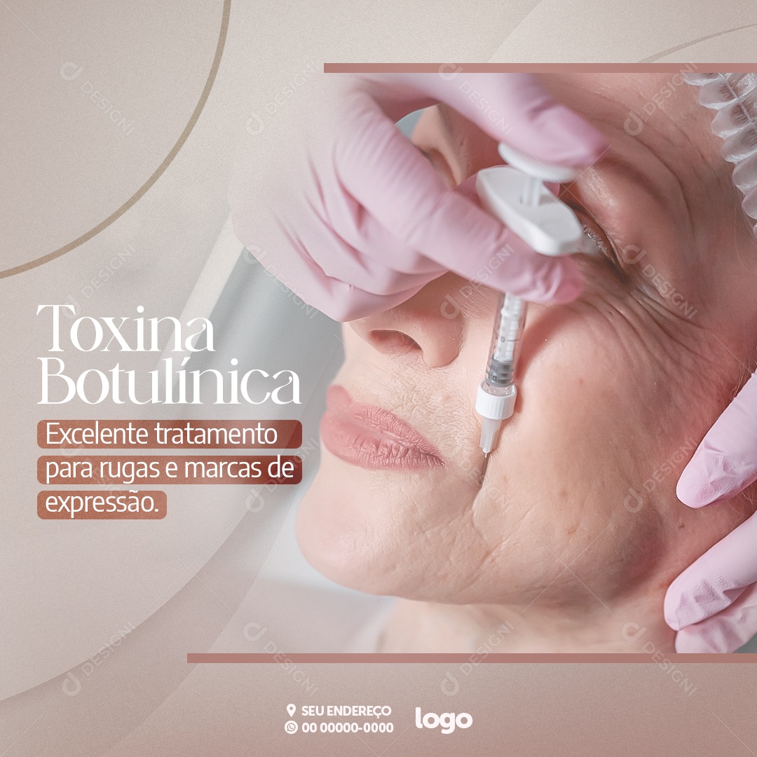 Estética Toxina Botulínica Social Media PSD Editavel