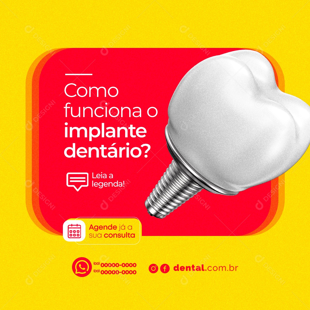 Como Funciona Um Implante Dentário Dentista Social Media PSD Editável