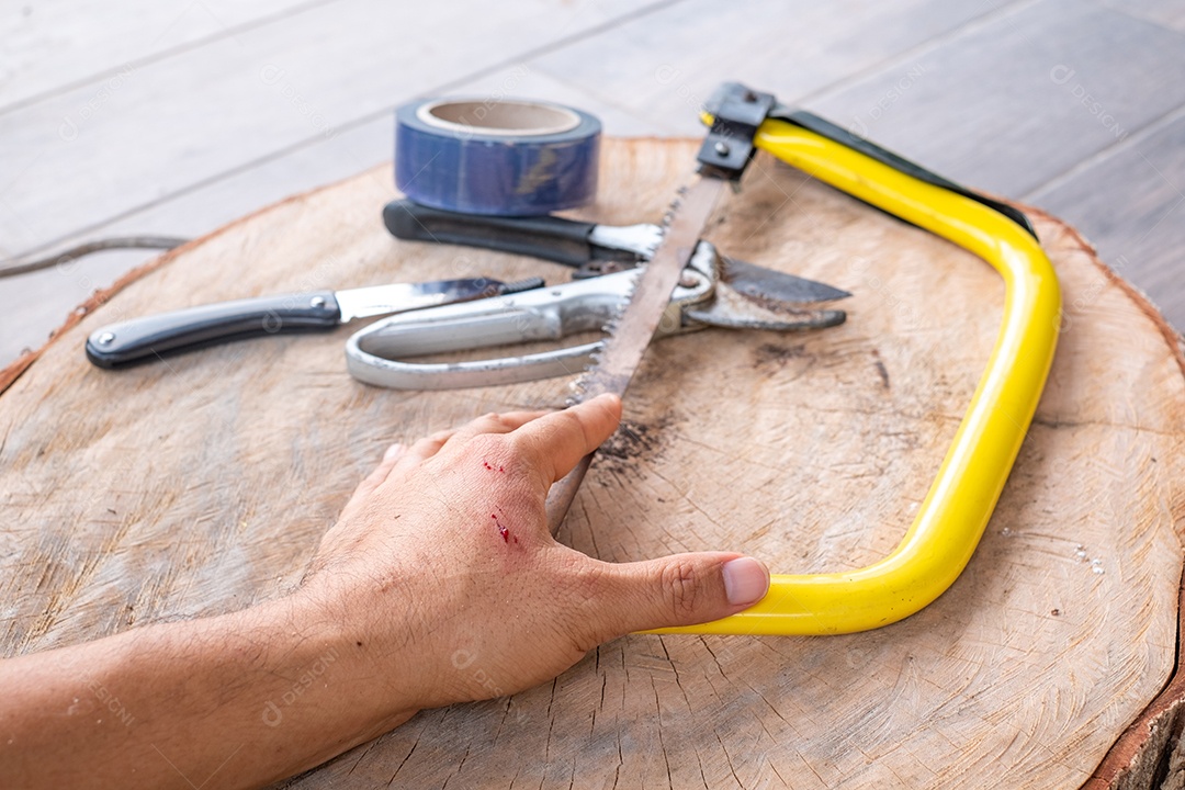 Mão do artesão com ferida sangrando, acidente de ferramenta durante o trabalho, seguro, acidente