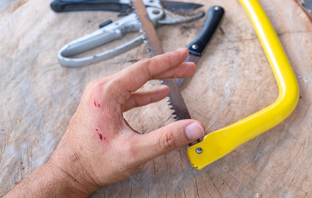 Mão do artesão com ferida sangrando, acidente de ferramenta durante o trabalho, seguro, acidente