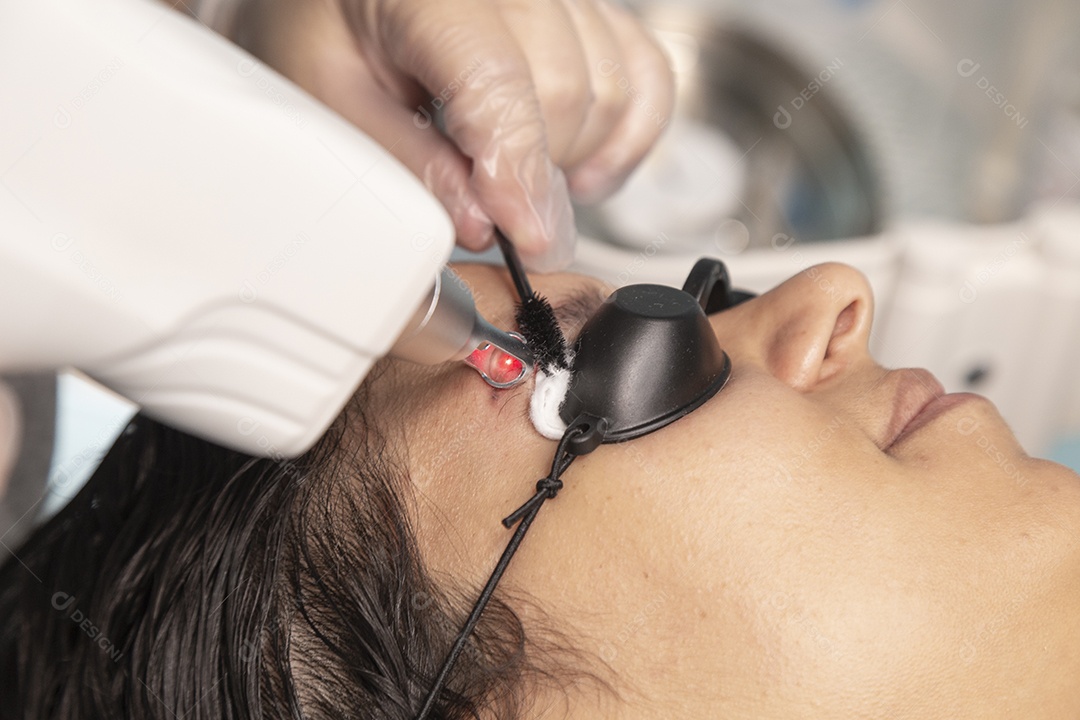 Mulher deitada, com espuma no rosto para despigmentar a sobrancelha