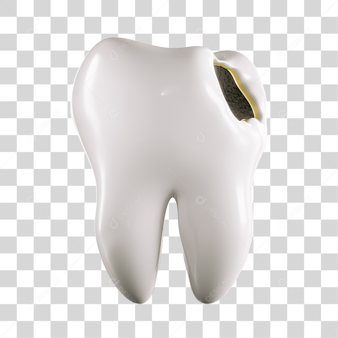 Elemento 3D Dente Cariado Para Composição PNG Transparente