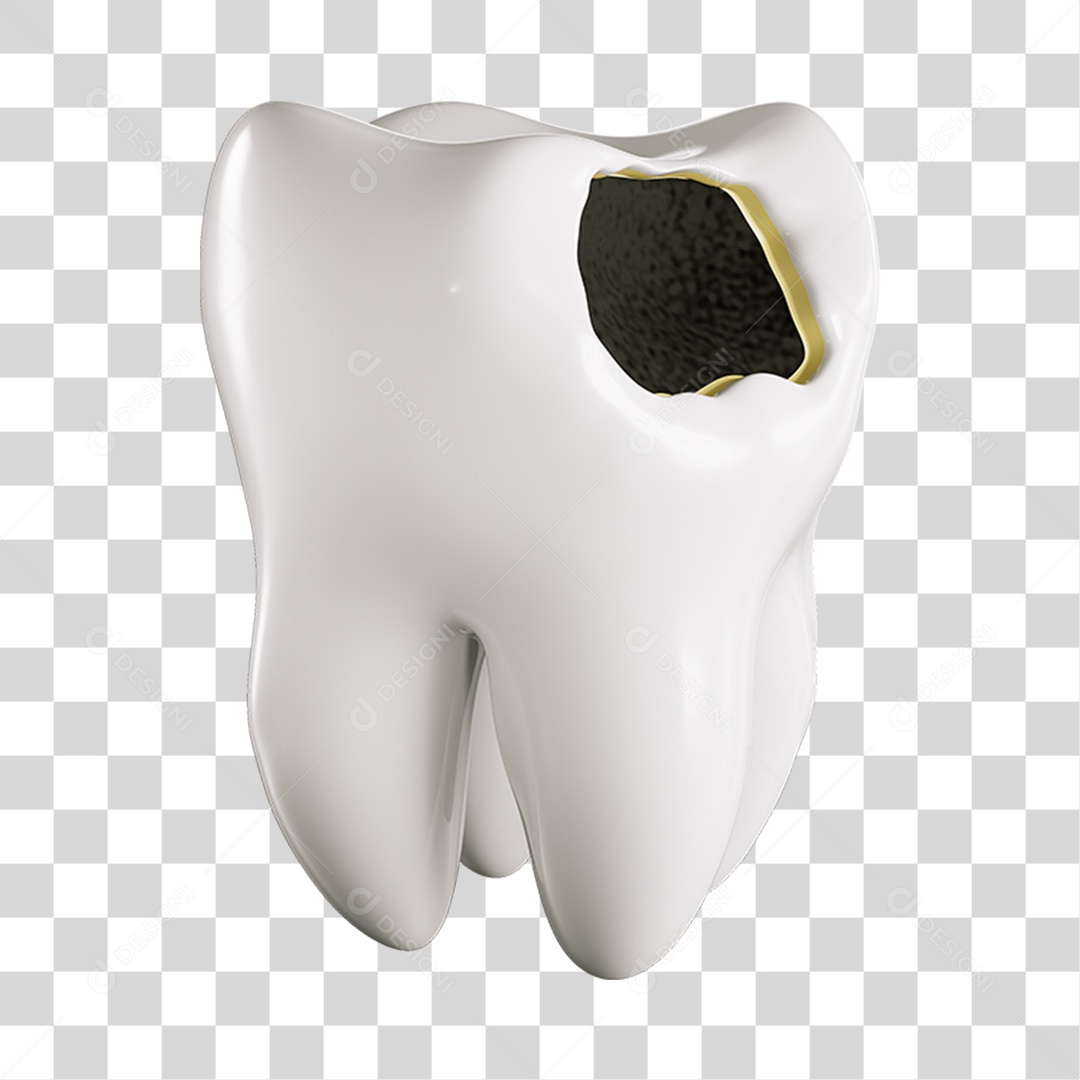 Elemento 3D Dente Cariado Para Composição PNG Transparente