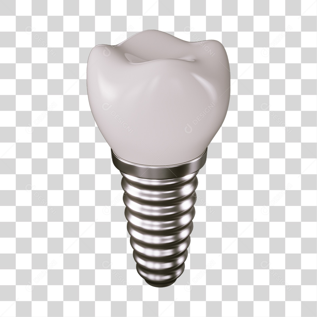 Elemento 3D Implante Para Composição PNG Transparente