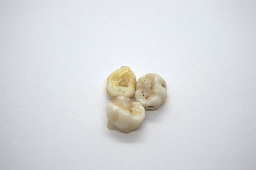 Dentes de leite de bebê isolados em fundo branco