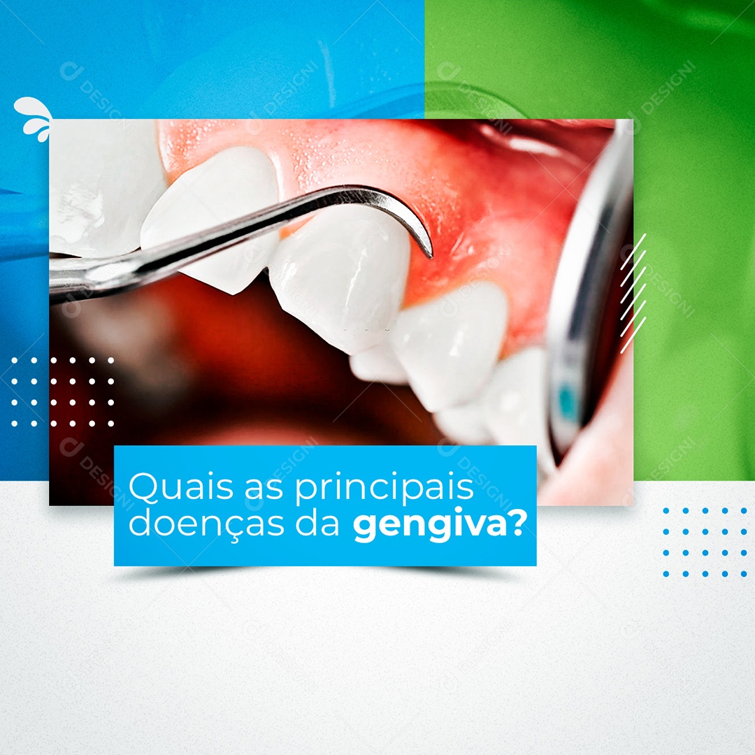 Quais as Principais Doenças da Gengiva Social Media PSD Editável