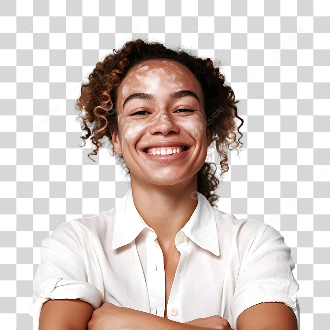 Mulher com Vitiligo PNG Transparente