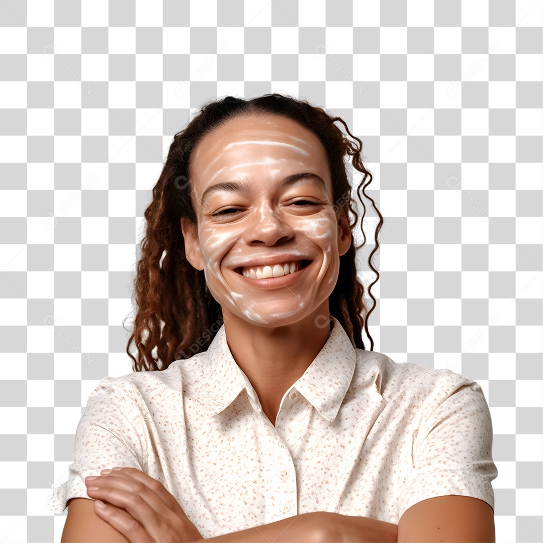 Mulher com Vitiligo PNG Transparente