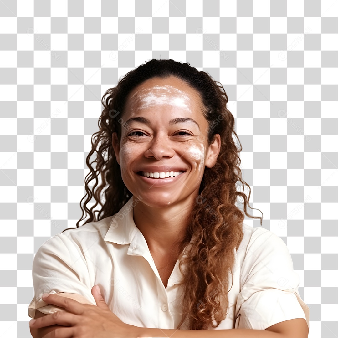 Mulher com Vitiligo PNG Transparente