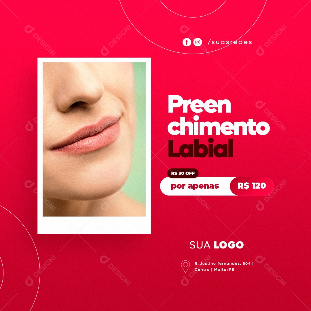 Clínica Estética Preenchimento Labial Social Media PSD Editável