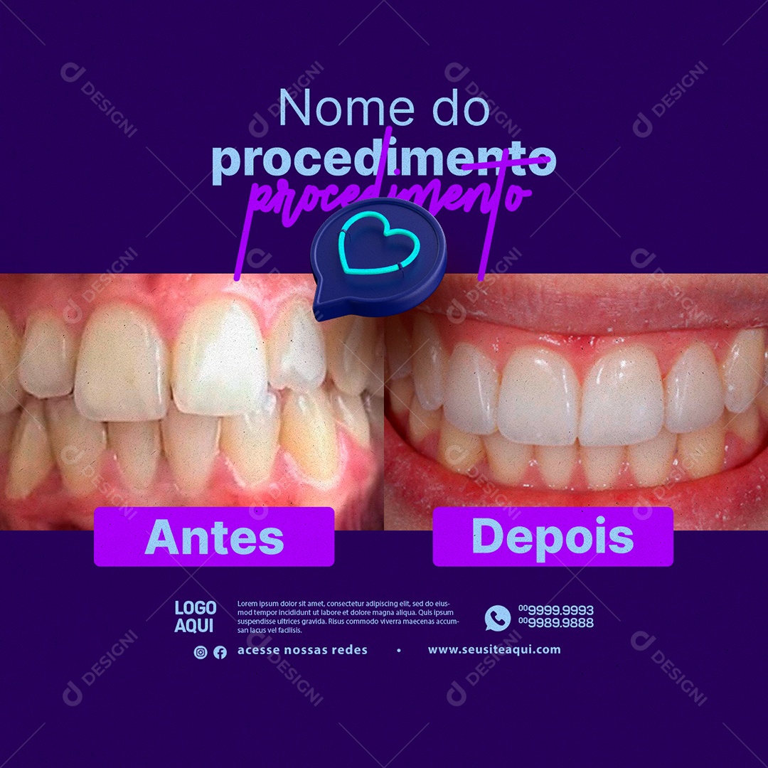 Odontologia Nome do Procedimento Antes e Depois Social Media PSD Editável