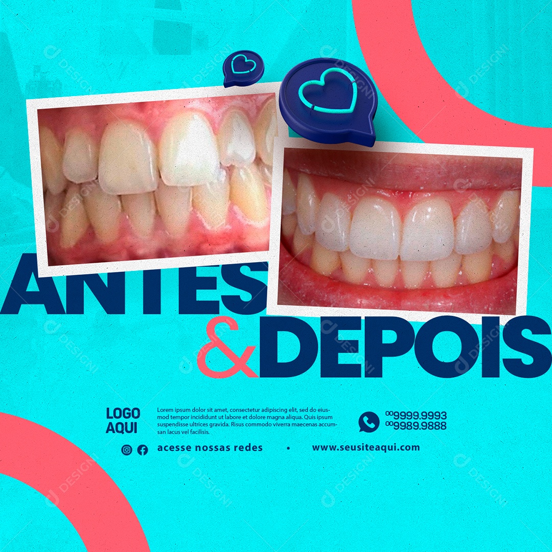Odontologia Antes & Depois Social Media PSD Editável