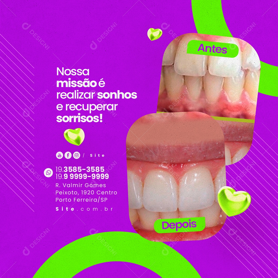Social Media Odontologia Nossa Missão é Realizar Sonhos e Recuperar Sorrisos Depois Antes PSD Editável