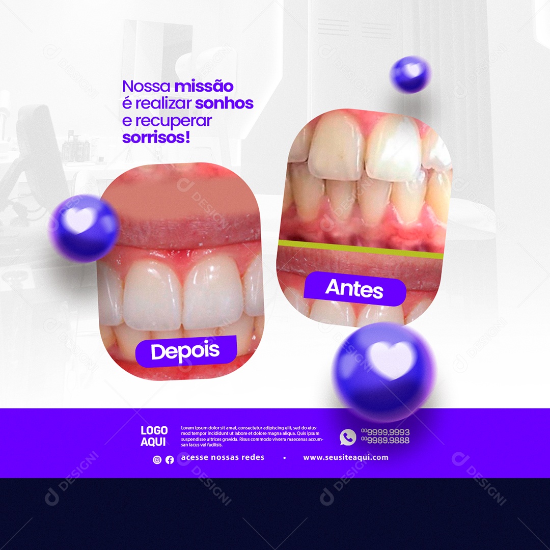 Odontologia Nossa Missão é Realizar Sonhos e Recuperar Sorrisos Depois Antes Social Media PSD Editável
