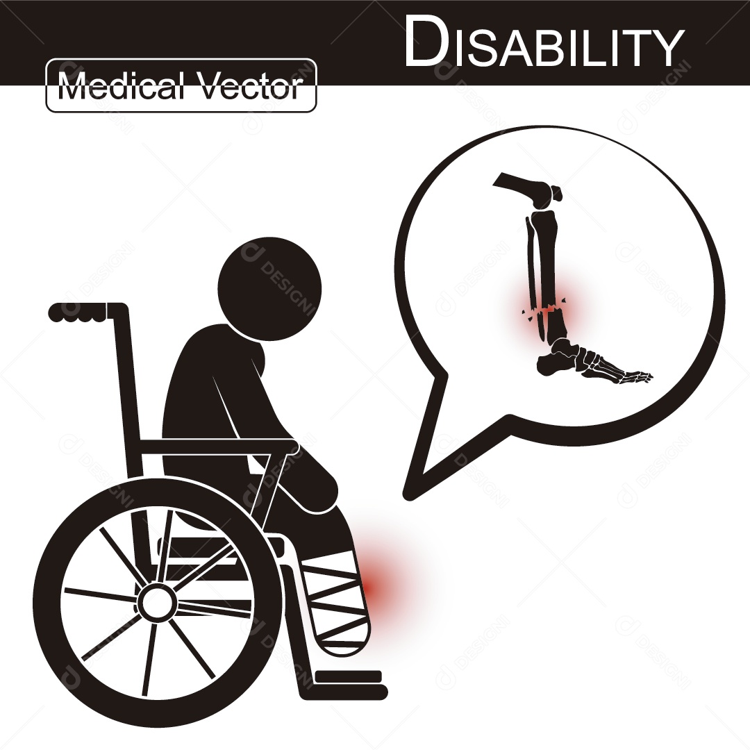 Fratura na Perna Ilustração Vetor EPS