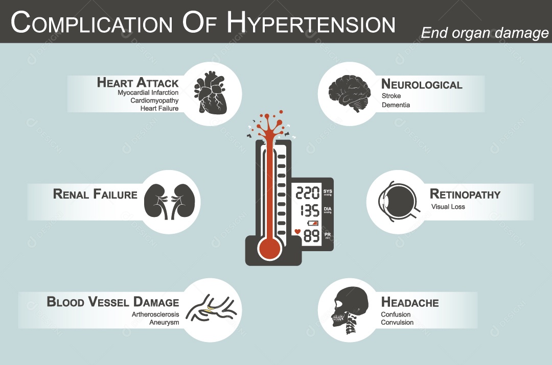Complicação da Hipertensão Vetor EPS