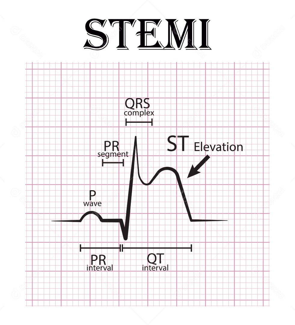 Gráfico de Eletrocardiograma Ilustração Vetor EPS