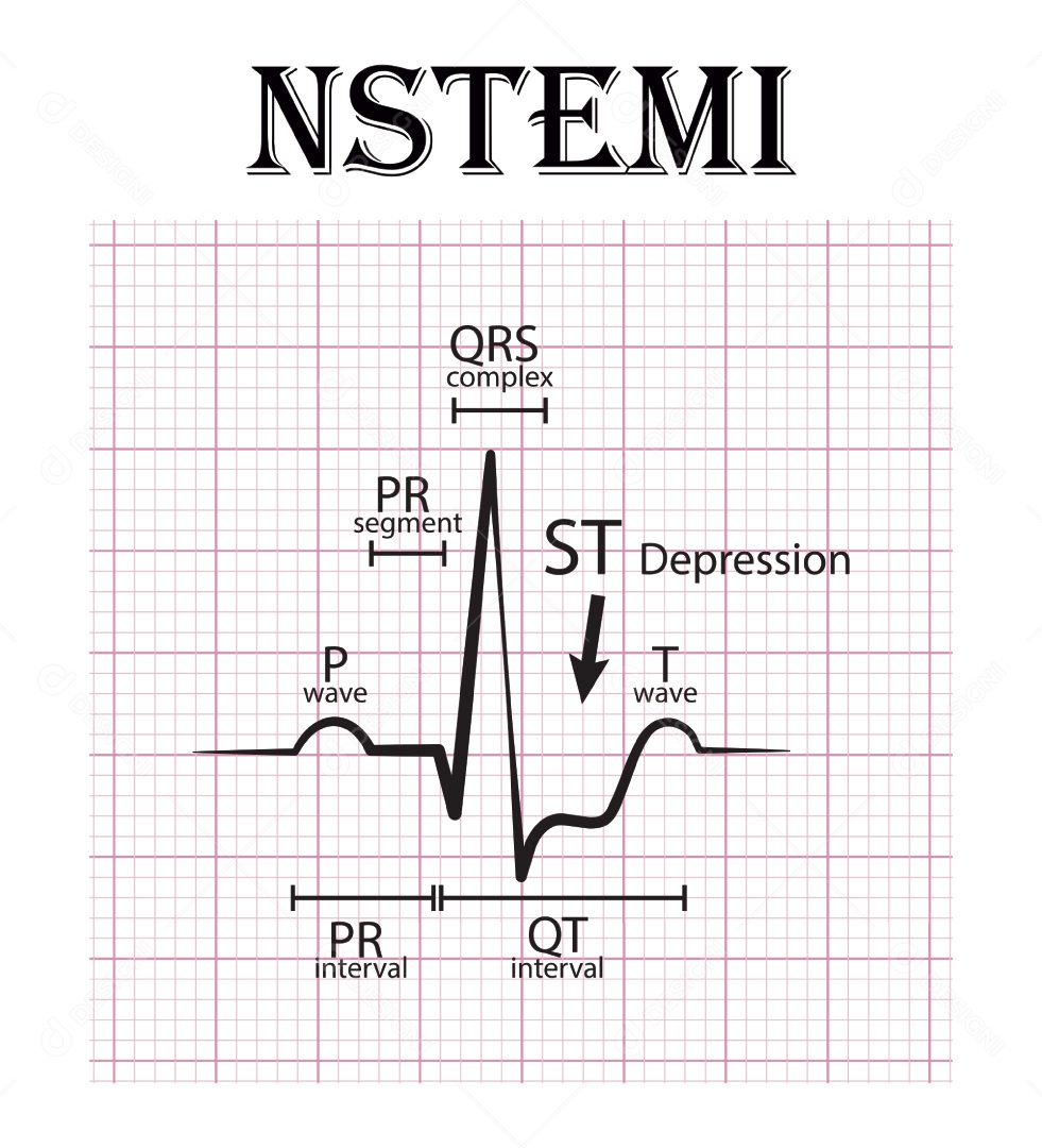 Gráfico de Eletrocardiograma Ilustração Vetor EPS